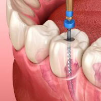 Endodontia